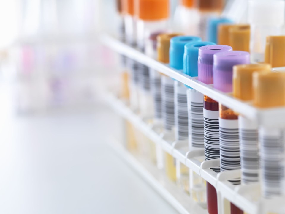 A shelf with test tubs waiting to be analyzed