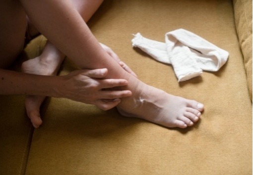 Athlete's foot issues