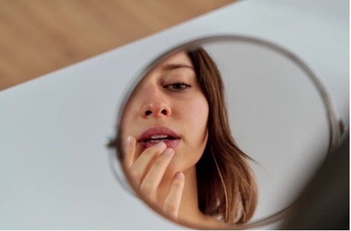 cold sore or fever blister